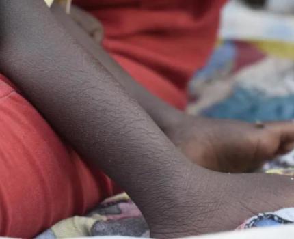 South Sudan: At least 75 people killed including three children as violence surges in Abyei
